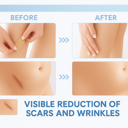 Silicone Scar Sheets
